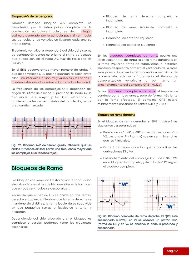 EKG 4